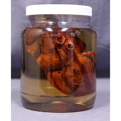 Heart Specimen Jar